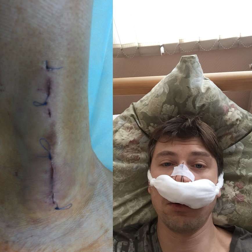 «Выздоравливайте!»: Алексей Ягудин обеспокоил фанатов снимками из больницы