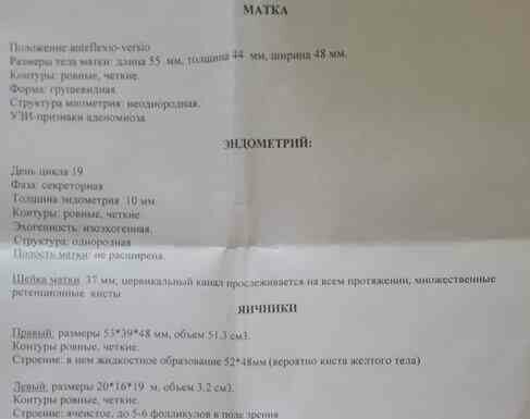 Чи можлива б?