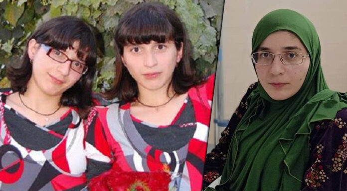 Онкологія та проблеми з нирками: одна з сіамських близнюків гіта потрапила до лікарні