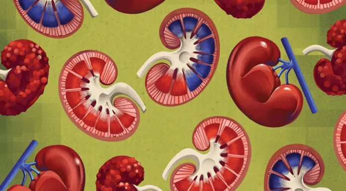 Прорив у лікуванні Нирок: Нові Методи, Покращені Діагнози та Надія для Пацієнтів